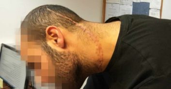כמה שווה תיק כיפה אדומה וחתך לכל אורך הפנים?