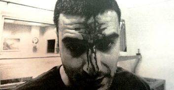 עבודות שירות לנאשם ש"פתח את הראש" לקצין בילוש