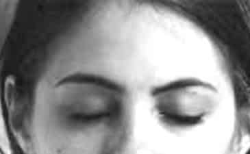 sad eyes