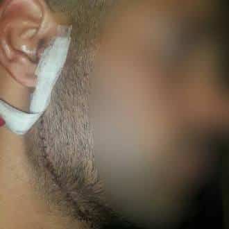 shisuf garon namal tel aviv