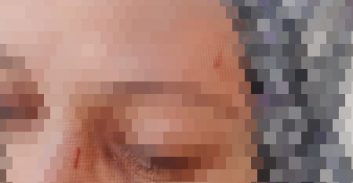 נעצר בחשד לתקיפת גרושתו וטען שהיא סוחטת אותו