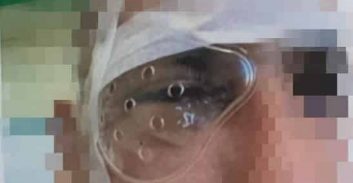 אישום: מוכר למשטרה תקף קשות בגלל ויכוח בתור לדואר