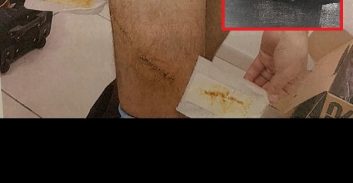 מברג לא מתאים ומתלונן שלא הגיע לדיון הובילו להסדר טיעון בתיק דקירה