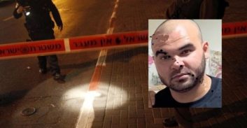 נקבע מותו של גבר שנורה בשכונת מושיירפה באום אל-פאחם